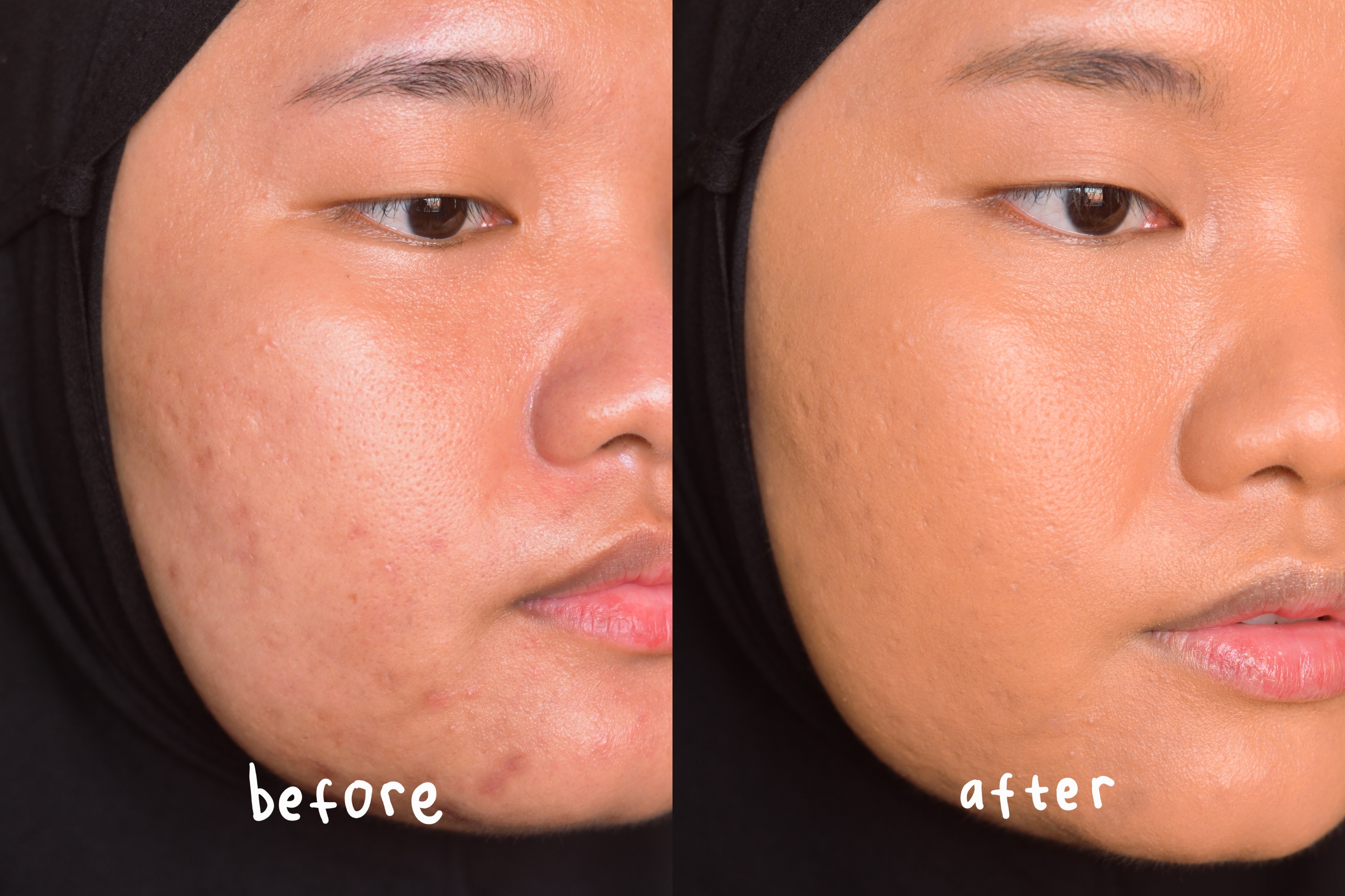 Coverage Test on Make Over Hydrastay Glow Fluid Foundation Coverage Test on Make Over Hydrastay Glow Fluid Foundation